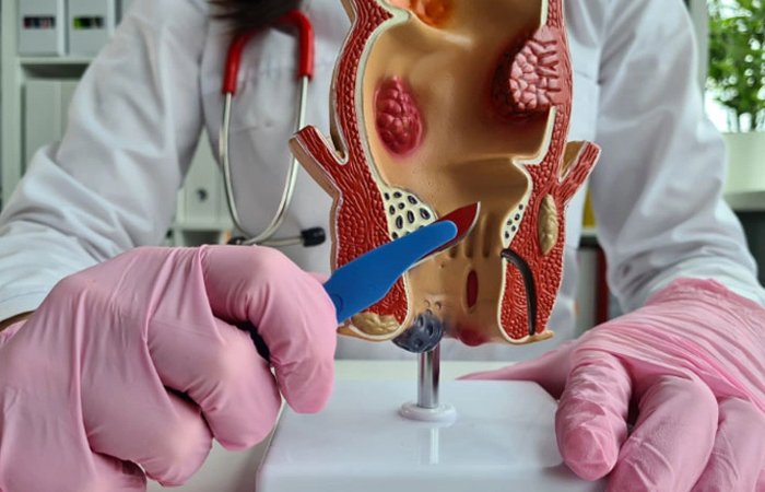Procto Dehradun - Best Proctologist in Dehradun, Piles Doctor in dehradun