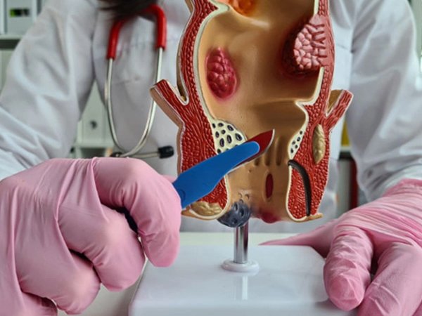 Procto Dehradun - Best Proctologist in Dehradun, Piles Doctor in dehradun