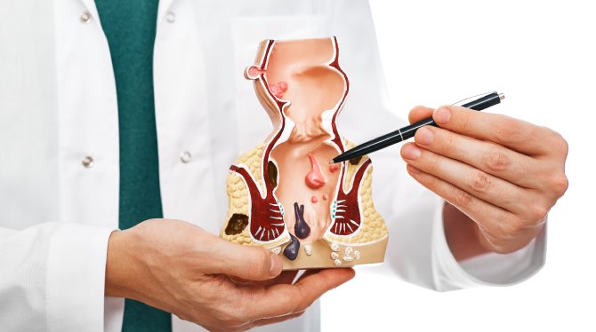 Procto Dehradun - Best Proctologist in Dehradun, Piles Doctor in dehradun Dr Lalit Chaudhry