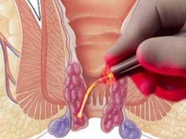 Procto Dehradun - Best Proctologist in Dehradun, Piles Doctor in dehradun